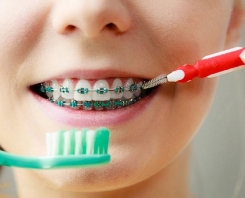 اورتودنسی دندان: علم صاف کردن دندان‌ها